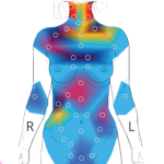 full body thermography